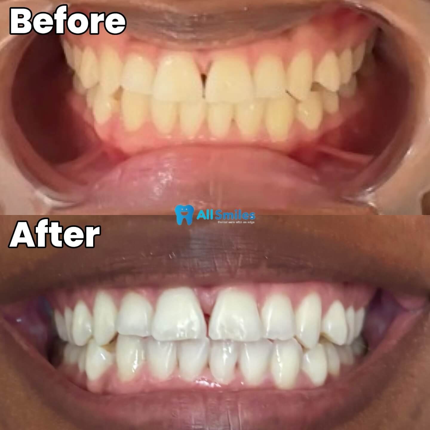 allsmilesng_1743650705343 (1)