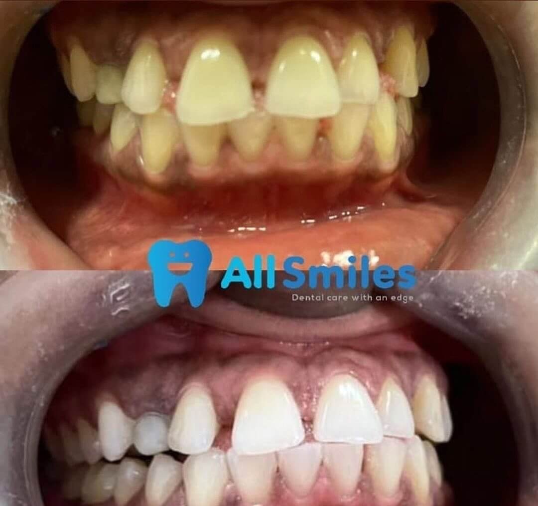 allsmilesng_1743650712888 (1)