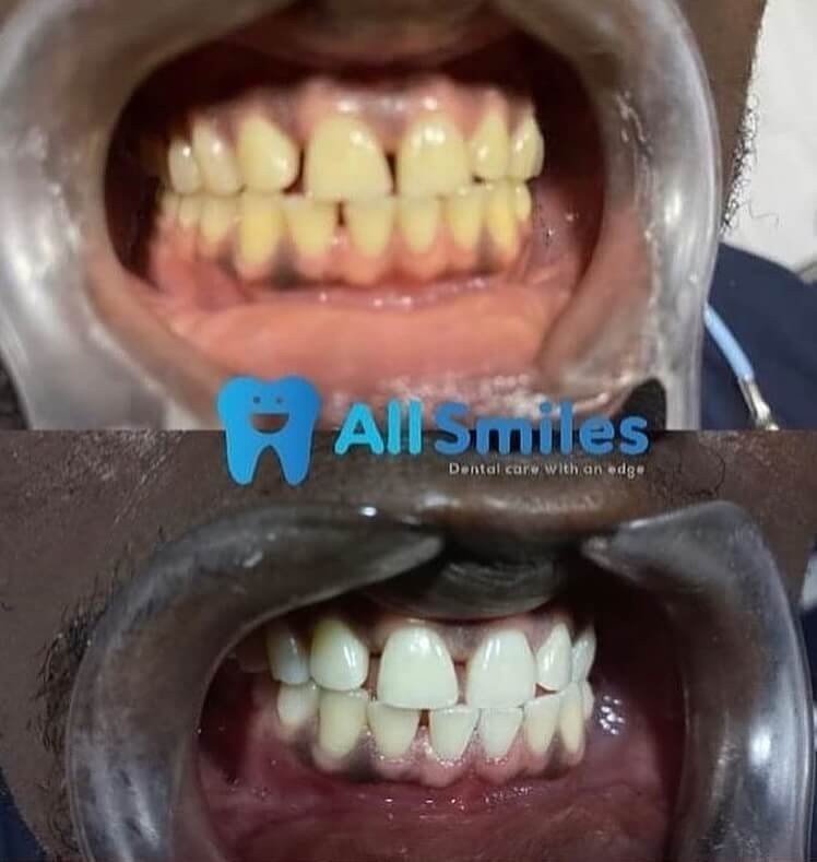 allsmilesng_1743650716484 (1)