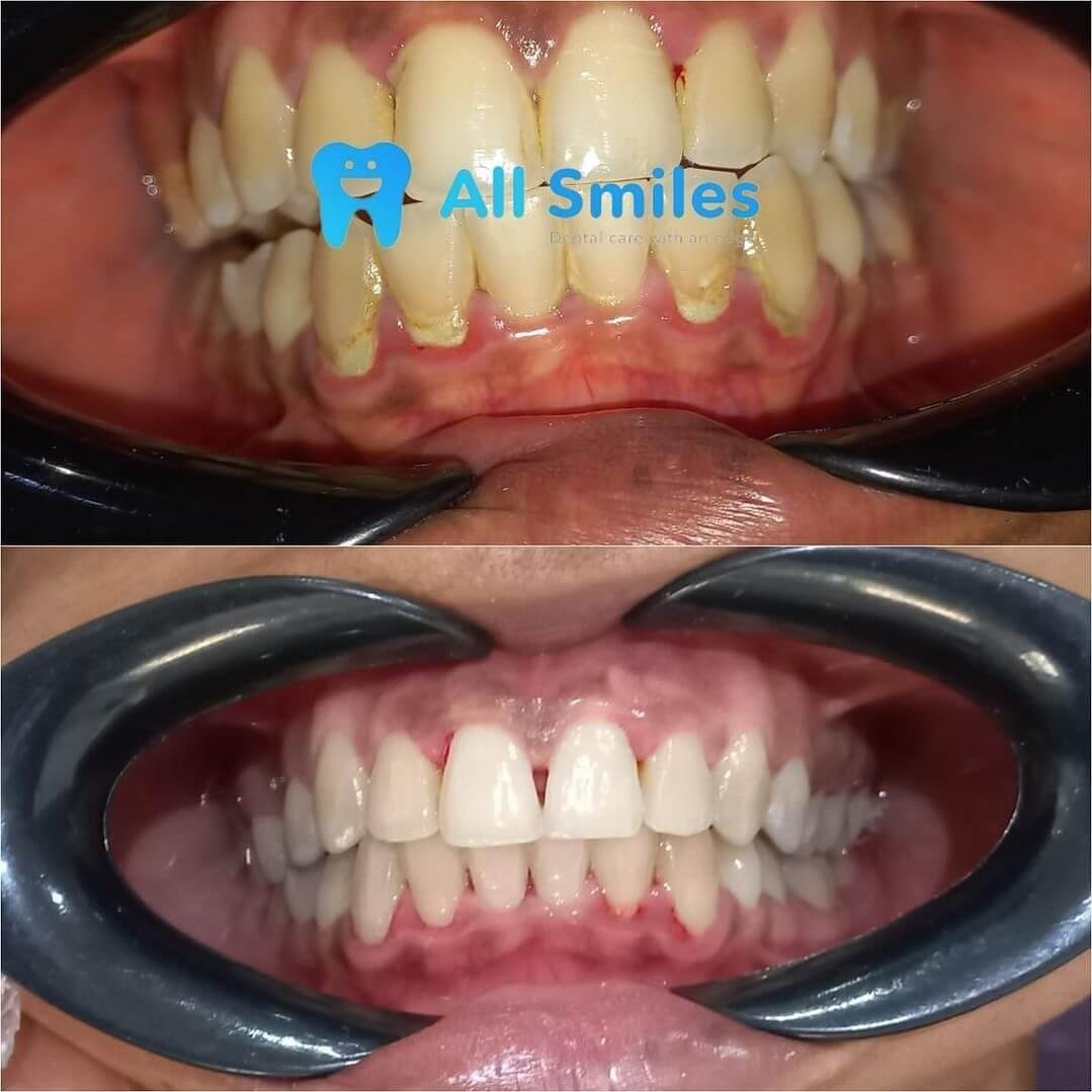 allsmilesng_1743650720138 (1)