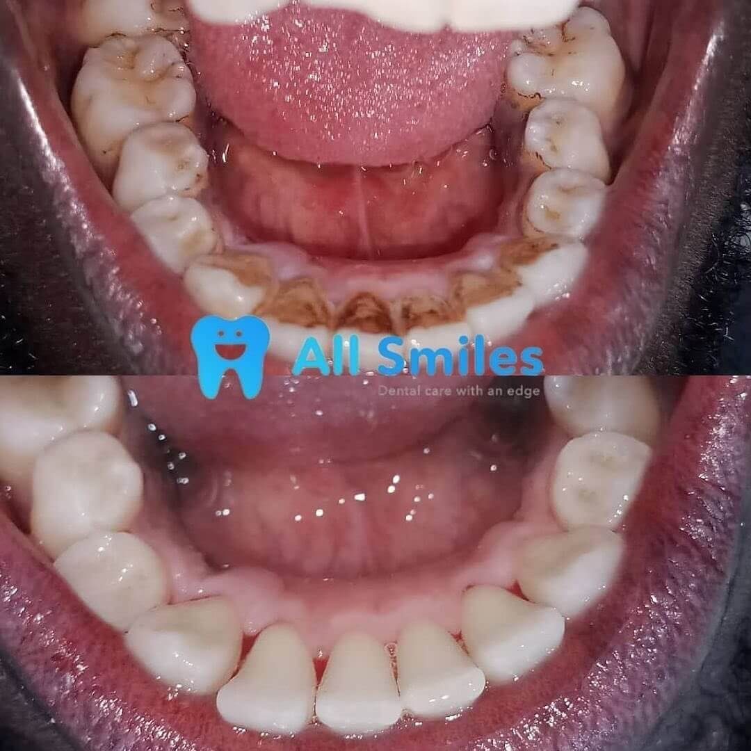 allsmilesng_1743650769122 (1)